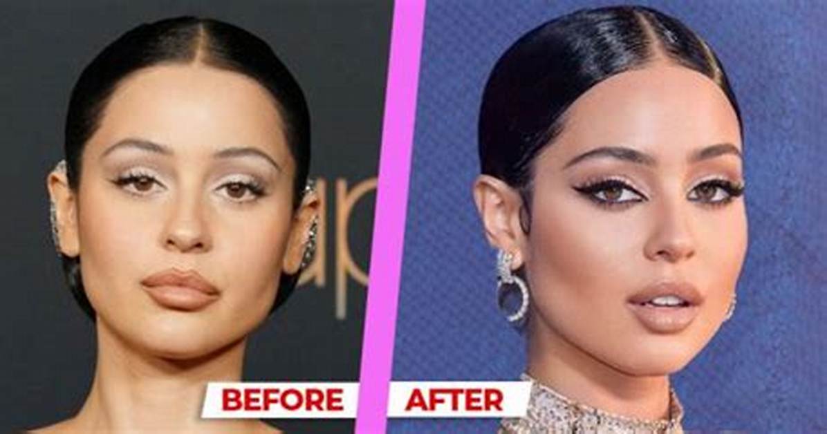 Alexa Demie Teeth Before and After Visual Proof of Her