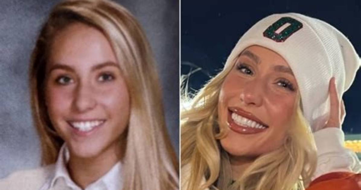 Alix Earle Before and After Side by Side Photos of Her