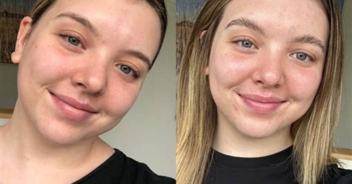 Before and After 7