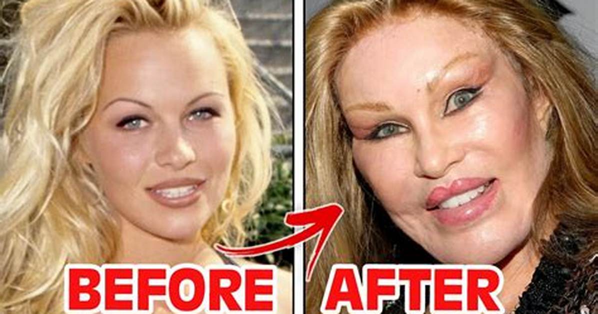 Before and After Extreme Procedures Visual Transformations Complications And