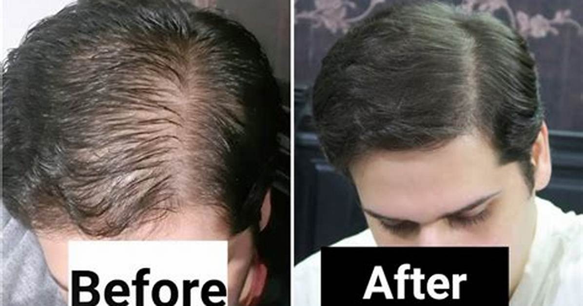 Before and After Nene S Hair Oil What the Real Growth Results and Ingredient Analysis
