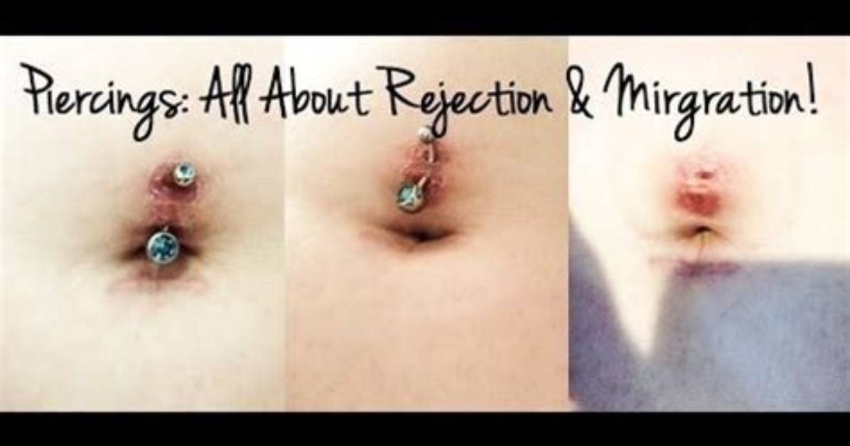 Belly Button Piercing Migration vs Rejection Visual Clues and How to Tell The