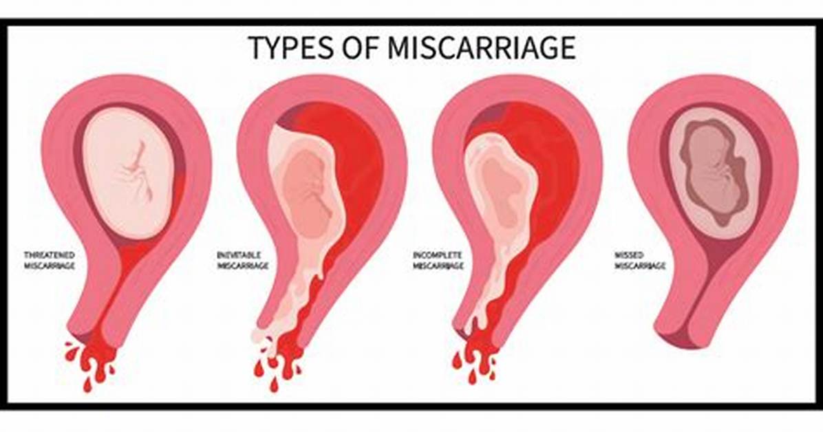 Can Lady Bloom Cause Miscarriage the Dangerous Truth Behind Herbal