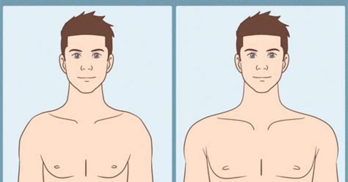 Can You Change Narrow Clavicles Fact Checking Workouts vs Clavicle Reduction And
