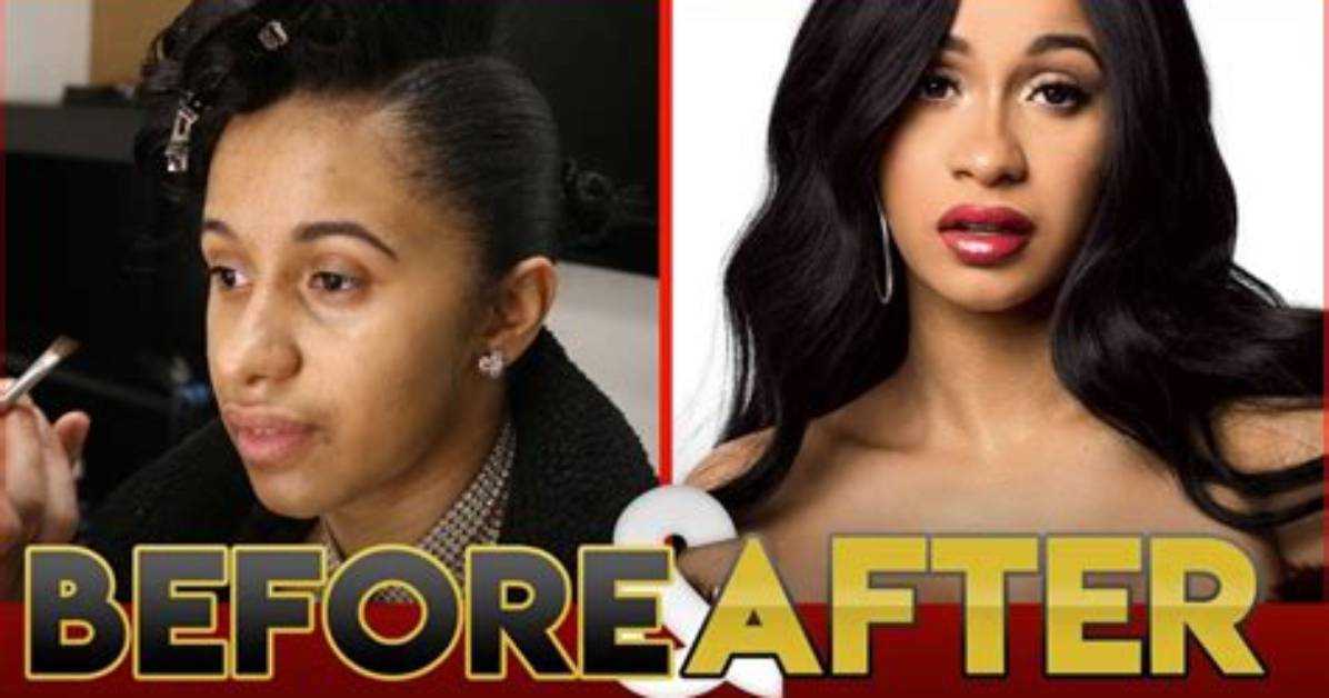 Cardi B S Bold Transformation from Cosmetic Speculation to That 15K