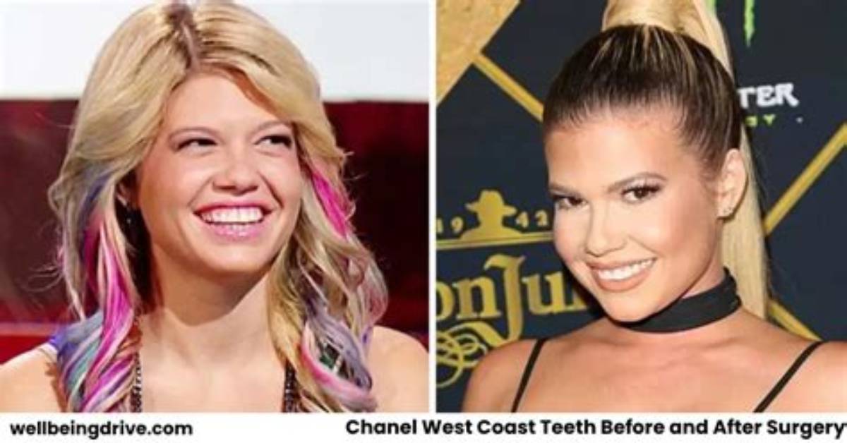 Chanel West Coast Teeth Before and After 2021 Visual Evidence And
