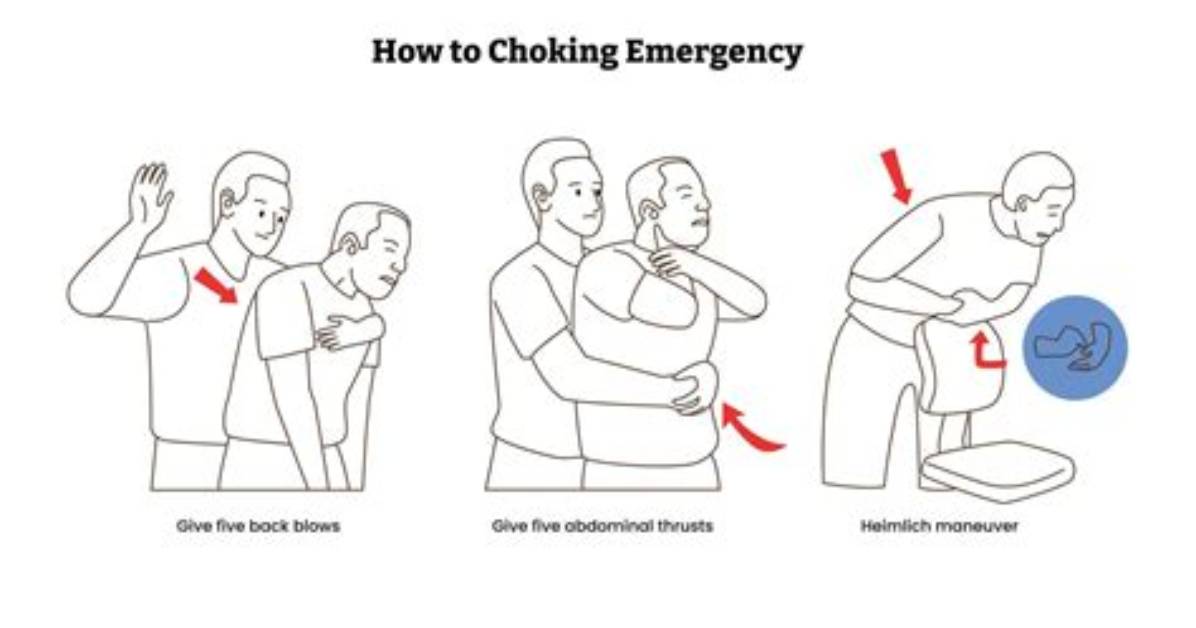 Choking Emergency or Harmless Spasm the Truth About Reverse Sneezing In