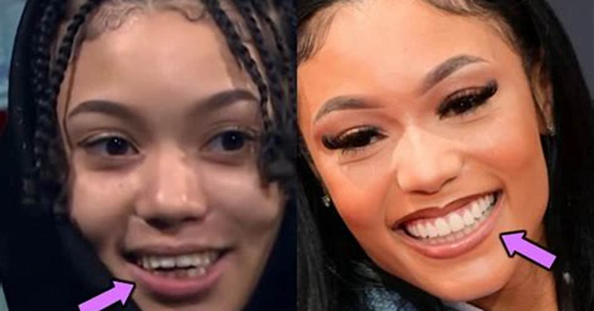 Coi Leray Before and After Breast Augmentation Visual Breakdown And