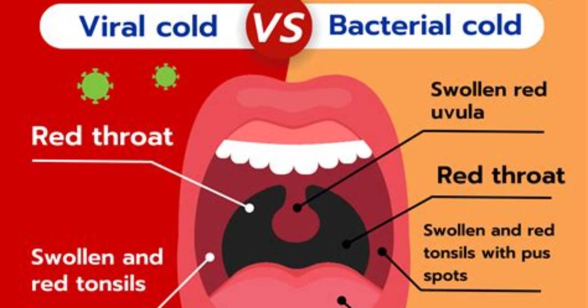 Cold Sore vs Bacterial Infection What Doctors See Under The