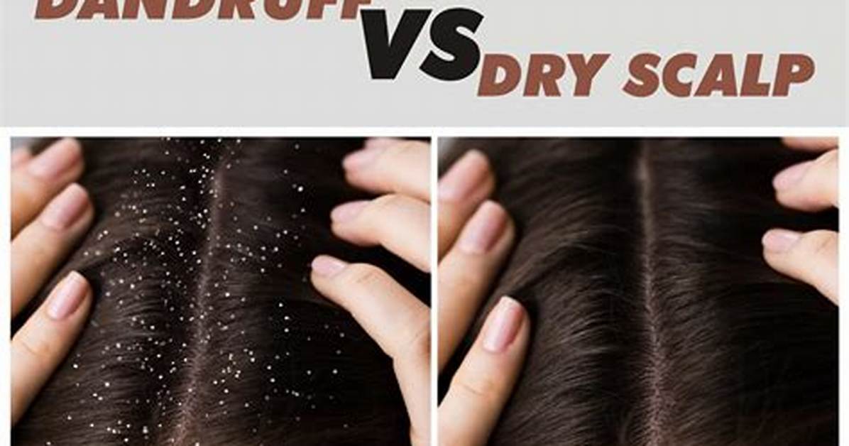 Dandruff vs Dry Scalp on Bald Heads Dermatologists Settle The