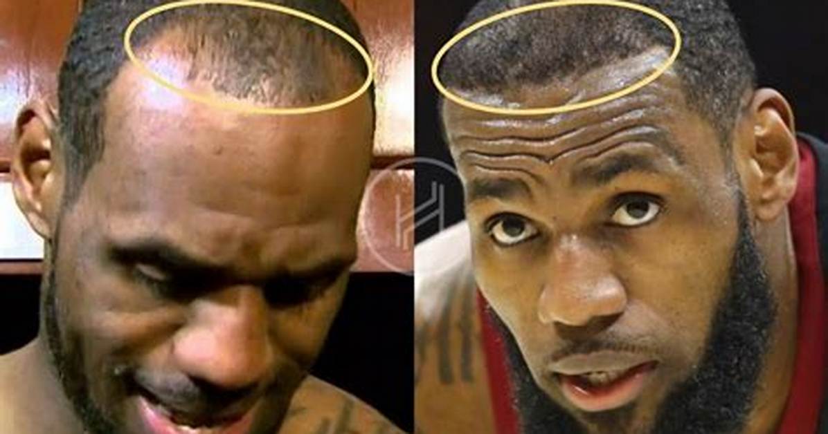 Did Lebron James Really Go Bald Inside the Dramatic Time100