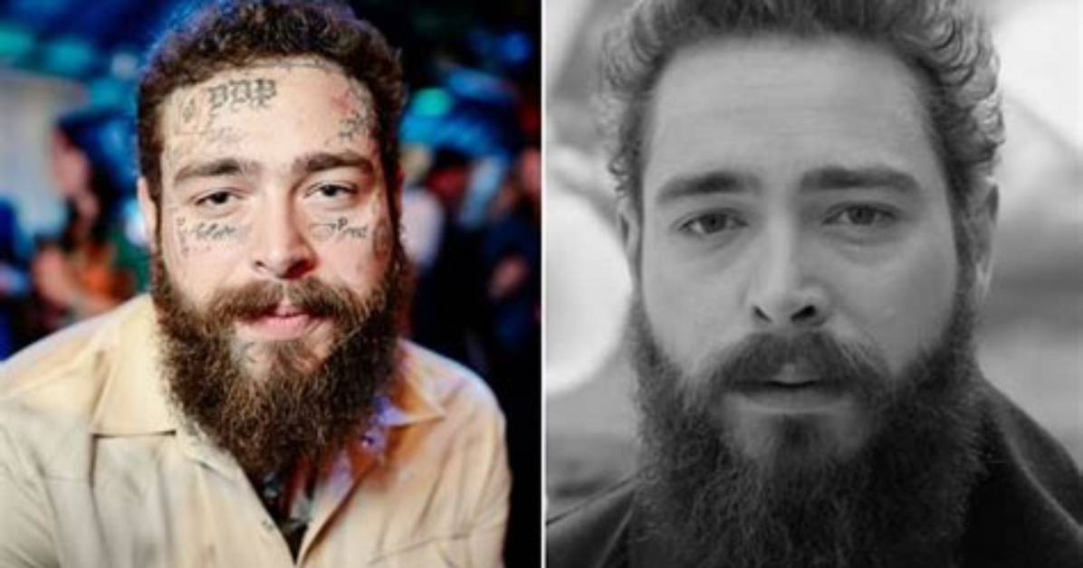 Did Post Malone Black out His Face Tattoos the Shocking Viral