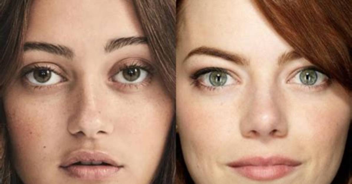 Does Ella Purnell Have an Eye Condition the Harrowing Near Blinding