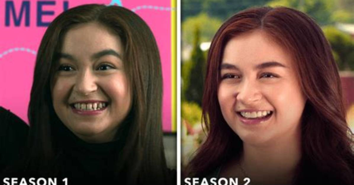 Fact Check Did Anna Cathcart Get Veneers or Orthodontic Treatment for Xo