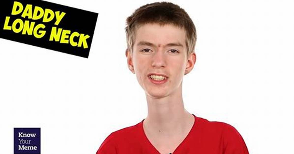 Fact Checking Daddy Long Neck Real Name Medical Background and True Net