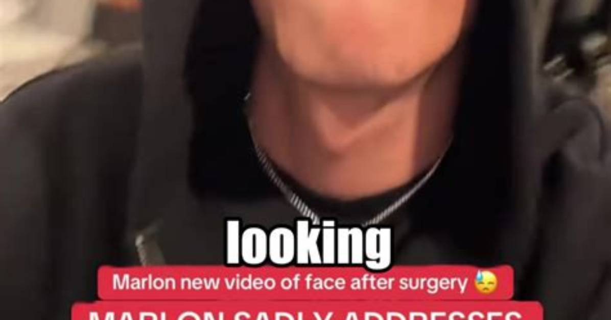 Fact Checking Marlon S Eye Surgery Real Incident Details Rumors And
