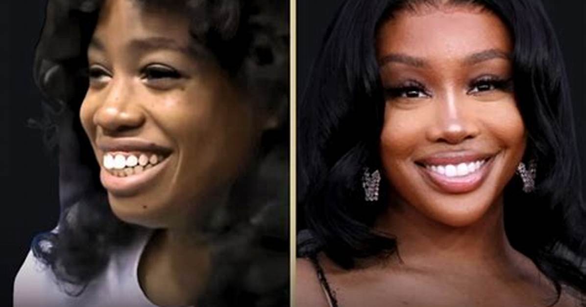 Fact Checking Sza S Plastic Surgery Timeline Exact Ages Procedures And