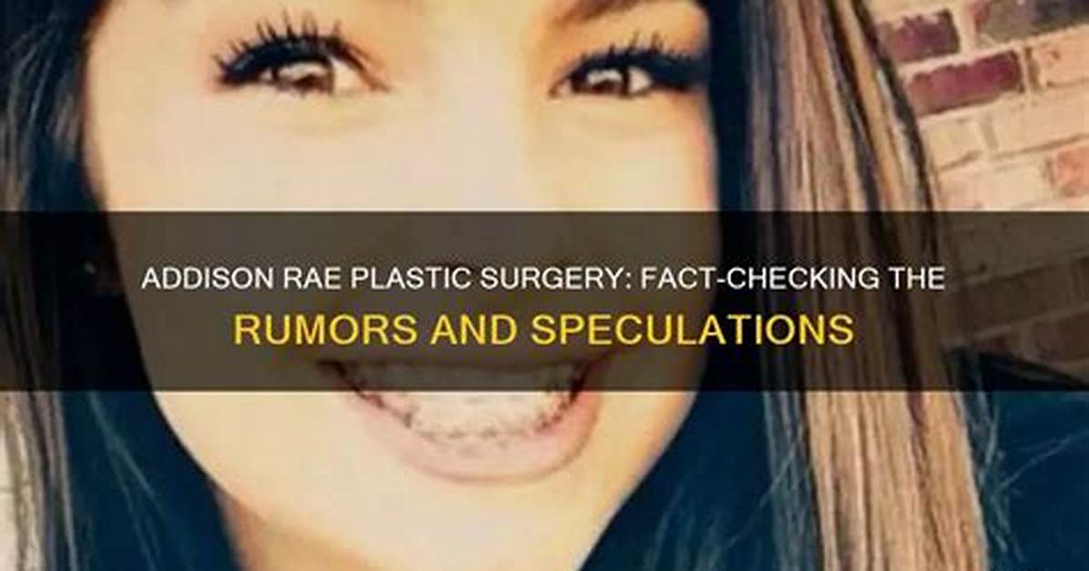 Fact Checking Vanessa Rae Adams Distinguishing
