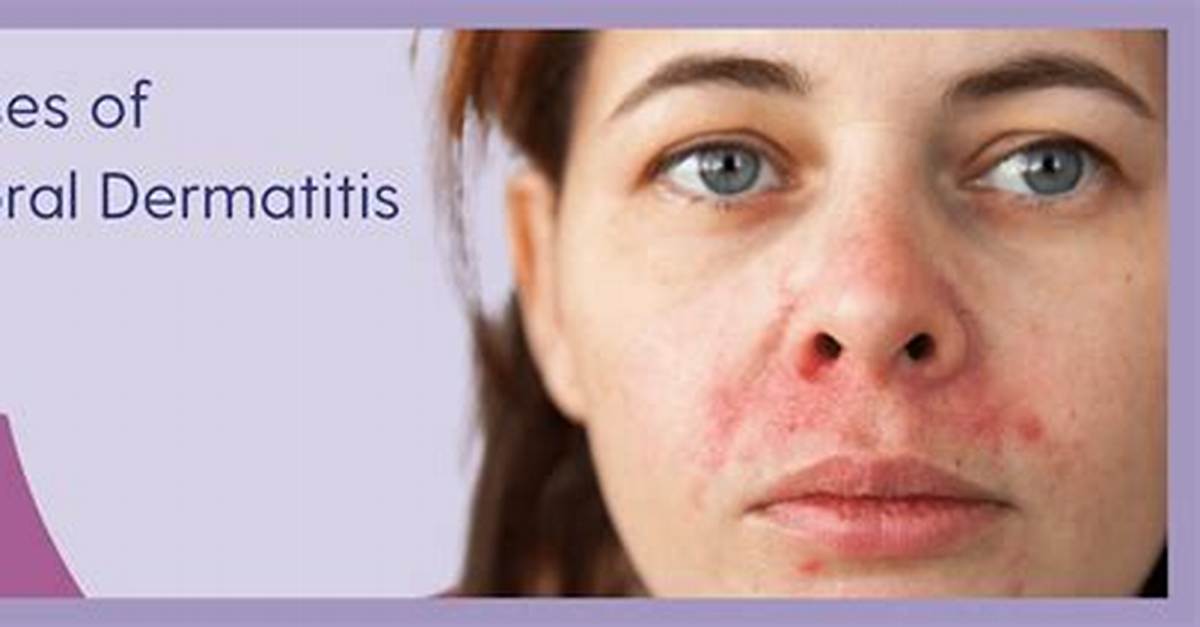 From Glass Skin to Severe Dermatitis How Viral Beauty