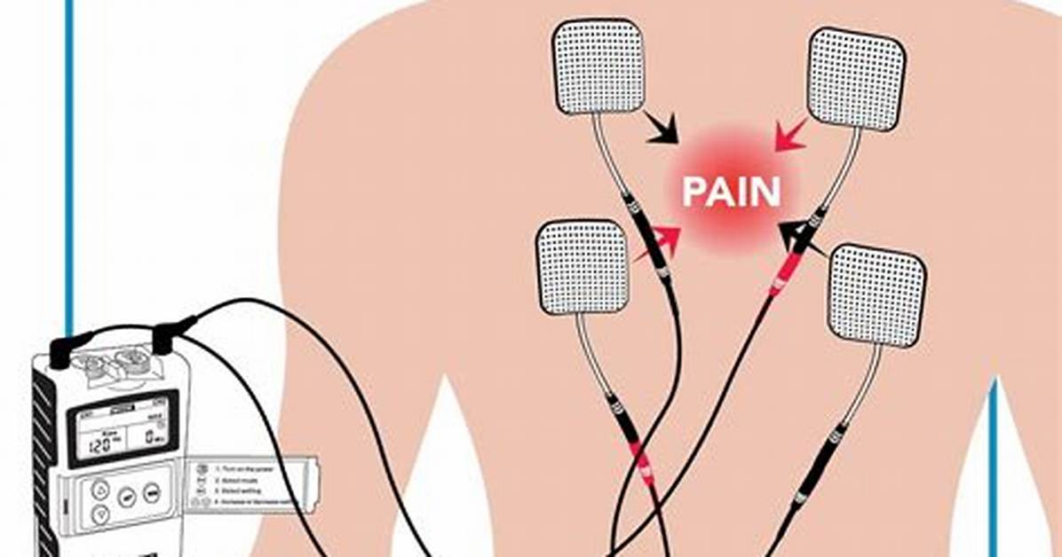 How to Use a Tens Unit for Muscle Knots Electrode Placement Settings And