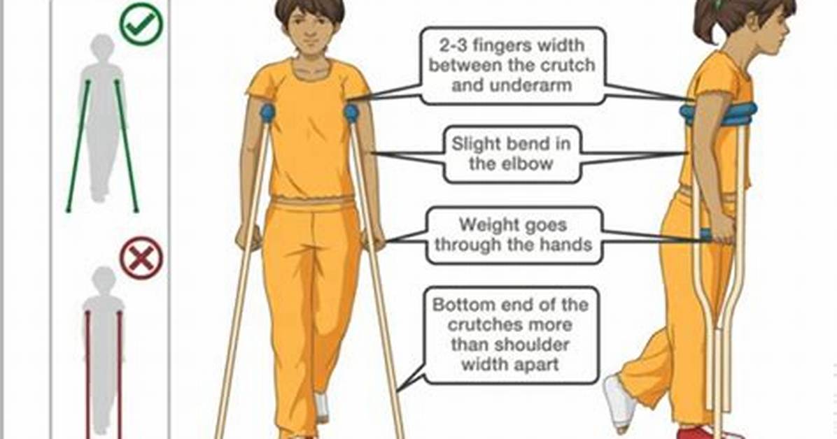How to Use Crutches Properly Complete Master Guide for Stairs Sitting And