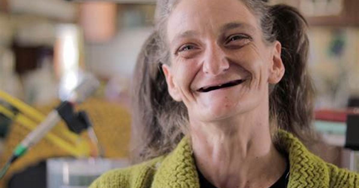 Inside Abby the Spoon Lady S Transformation Viral Videos Dental Rumors And