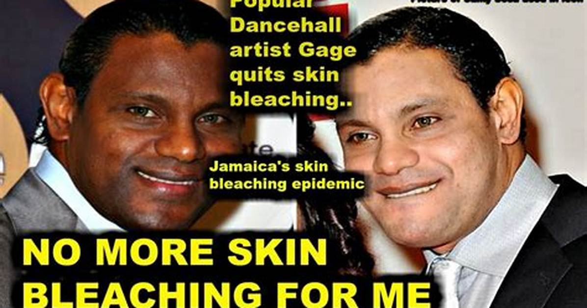 Inside Jamaica S Skin Bleaching Epidemic Why Lighter Skin Remains A