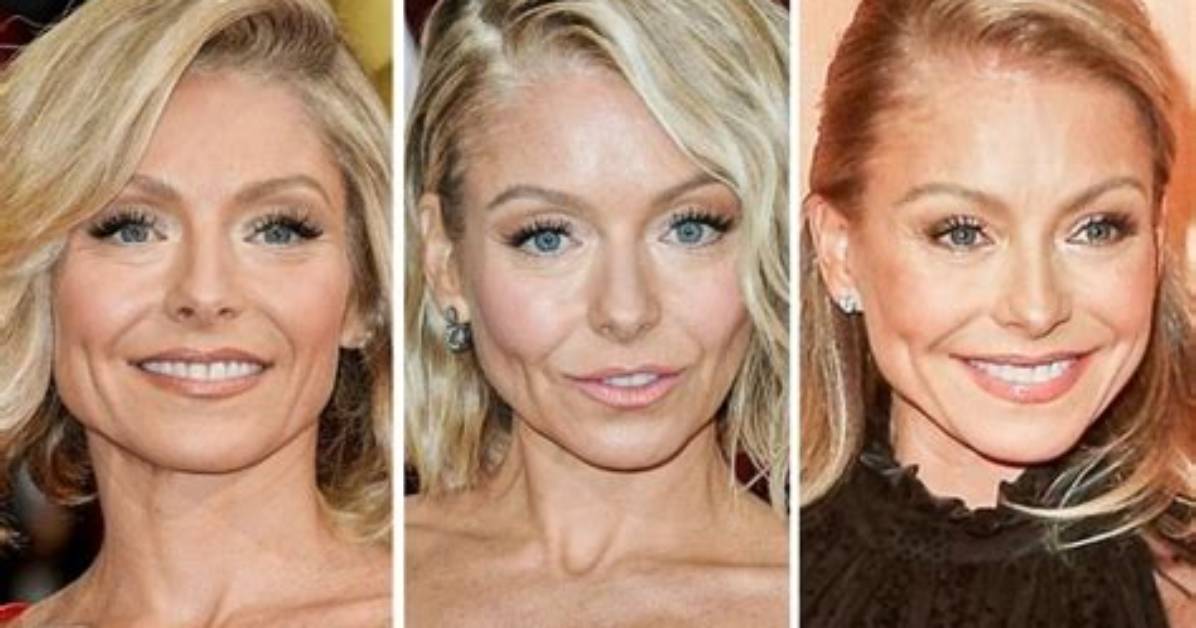 Kelly Ripa Before and After the Photos Reigniting Plastic