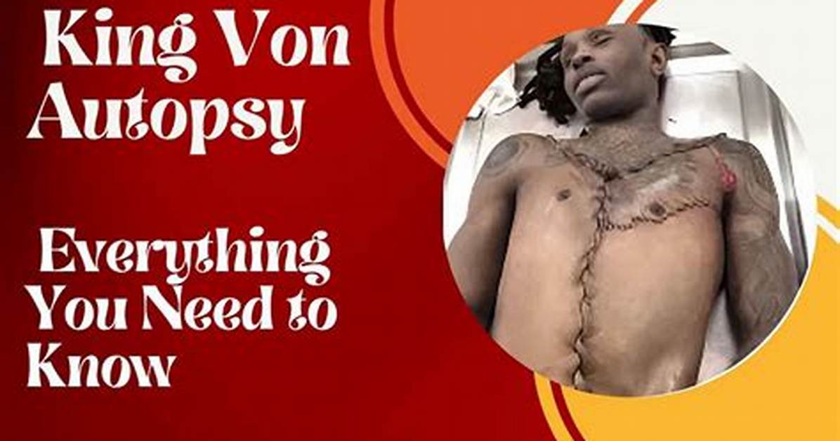 King Von Autopsy Leak Explained Faqs on the Mortician Scandal Legal Repercussions And