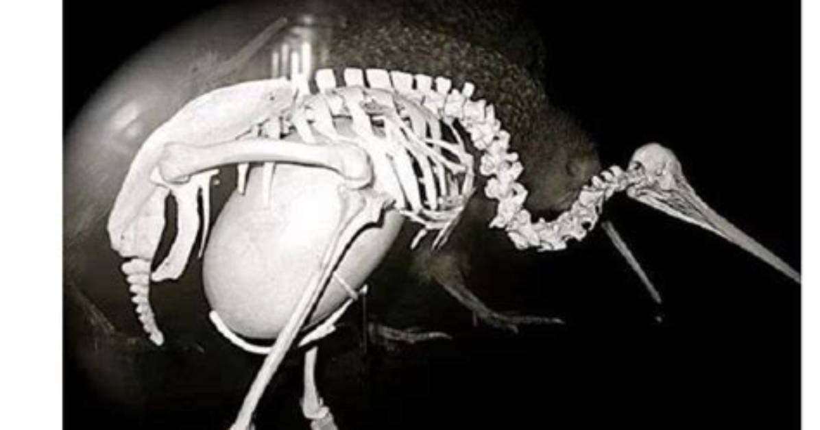 Kiwi Bird Egg Size Proof X Rays Anatomy Comparisons And