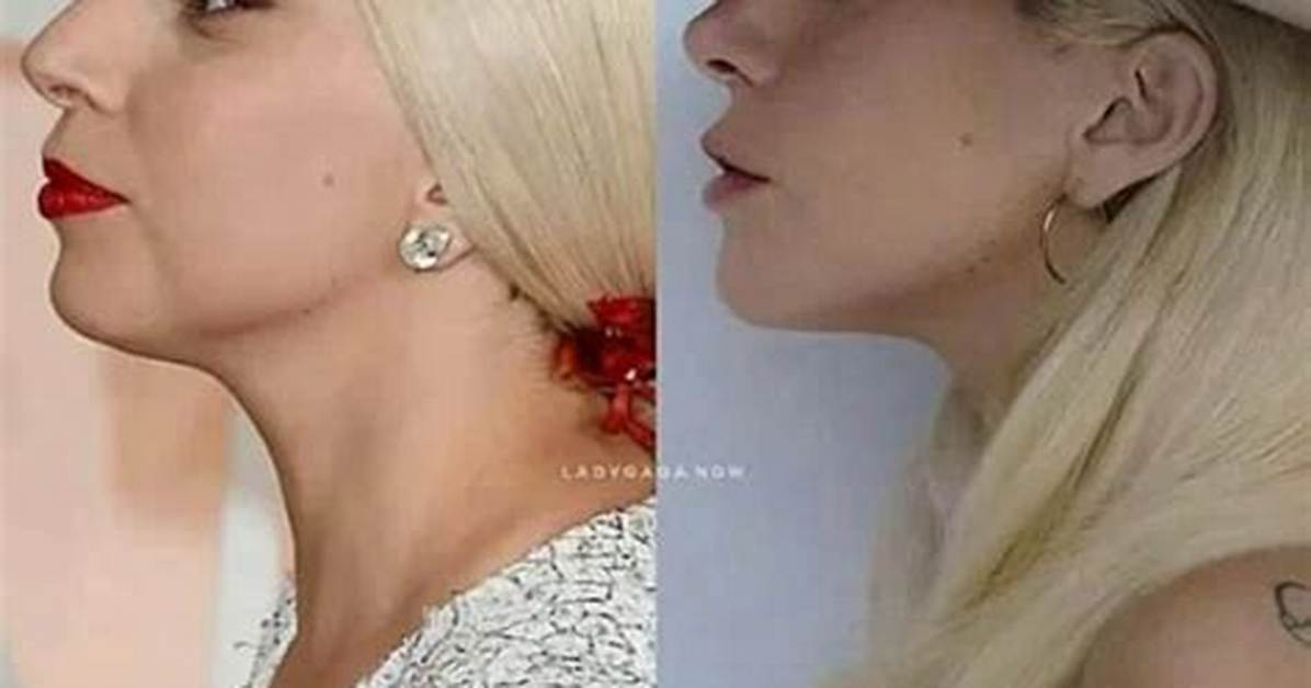 Lady Gaga S Journey as A
