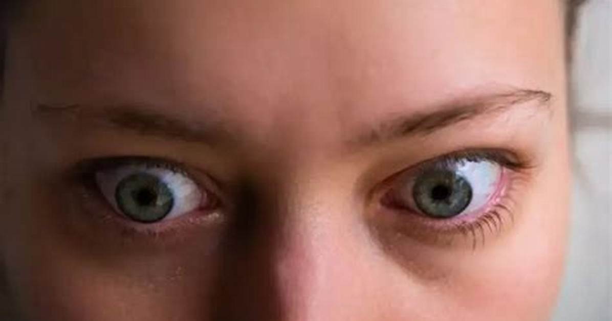 Large Eyeballs vs Bulging Eyes Key Differences You Need To
