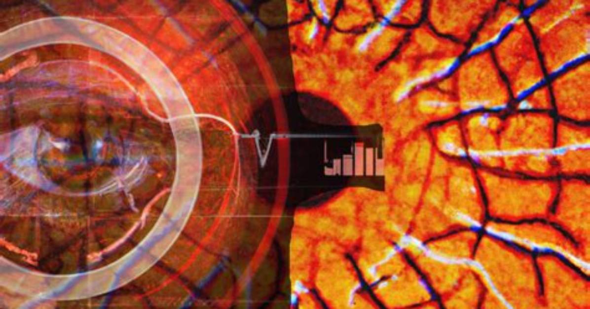 Looking Through the Eyes How Retinal Biomarkers and Doppler Waves Expose Abnormal