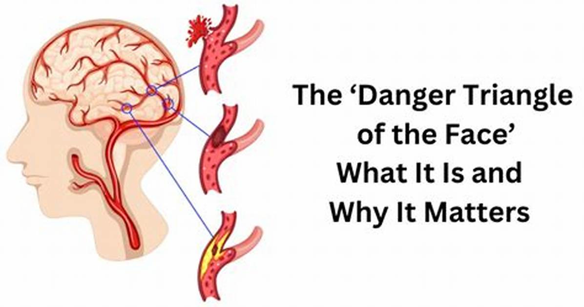 Mapping the Danger Triangle Visual Medical Evidence Behind the Nose