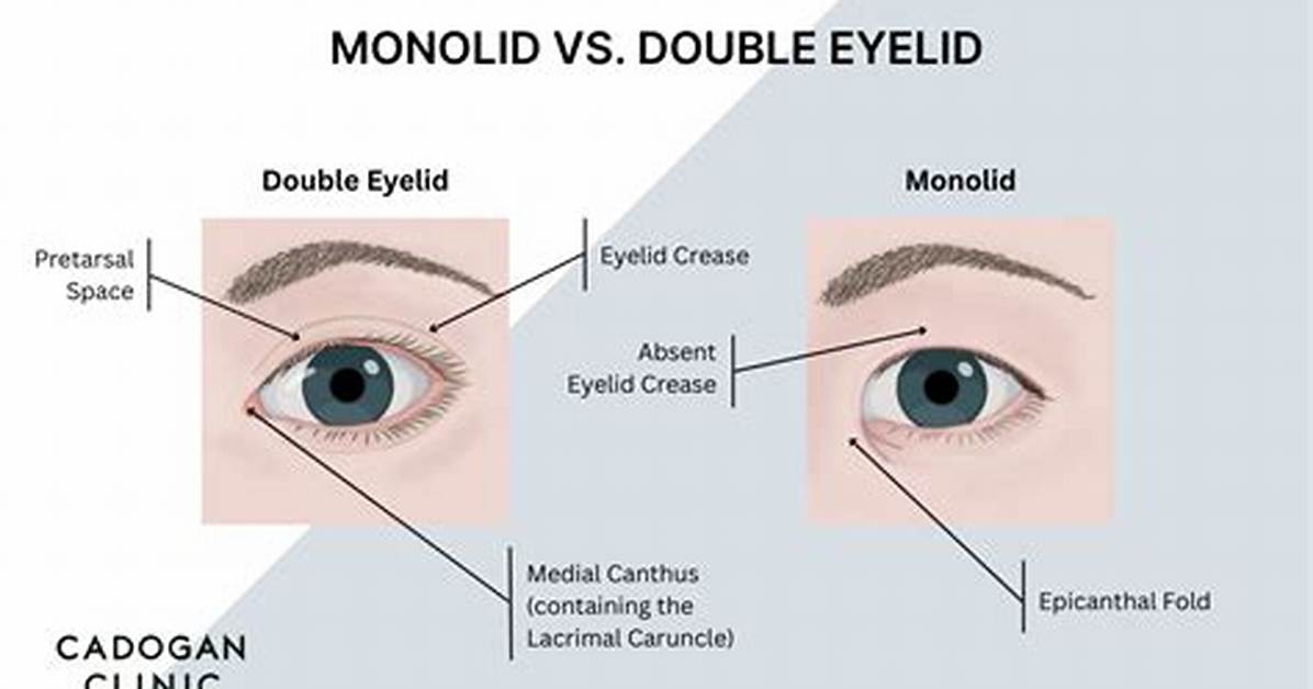 Monolids vs Double Eyelids Visual Breakdown Anatomy And