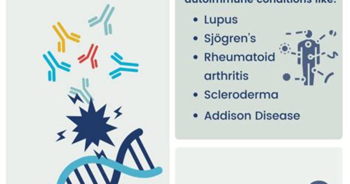 Positive Ana Test Meaning Why a Pos Ana Result Does Not Always