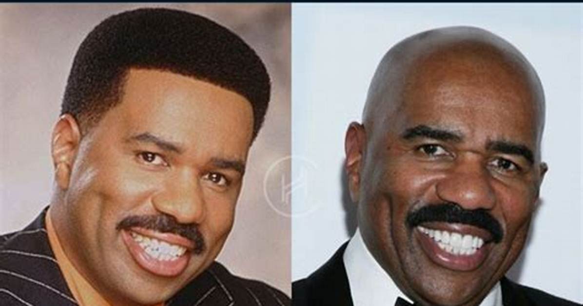 Steve Harvey S Teeth Before and After Visual Proof of His