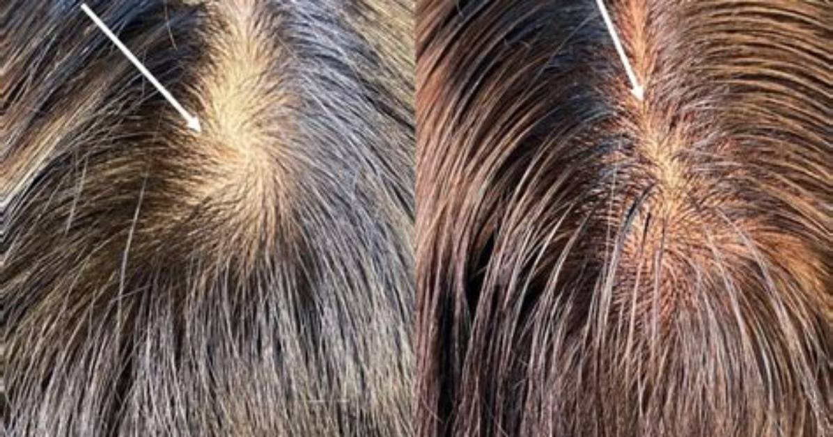 Stop Fighting Your Cowlick the Haircut Mistake Making It Look 10X