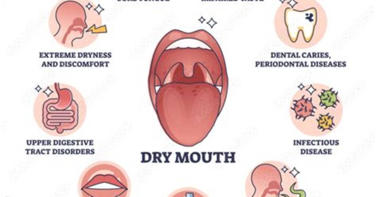 Sudden Excess Saliva Fact Check Debunking Common Myths About