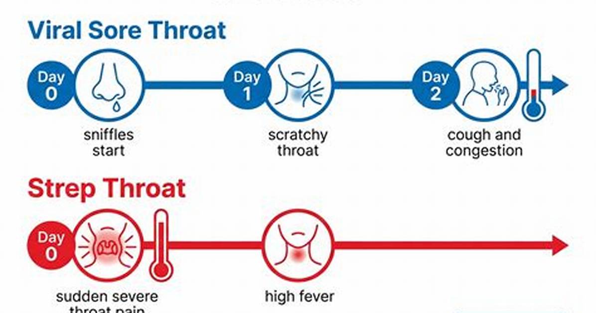 Surge in Severe Sore Throat Cases Timeline of the Winter 2025