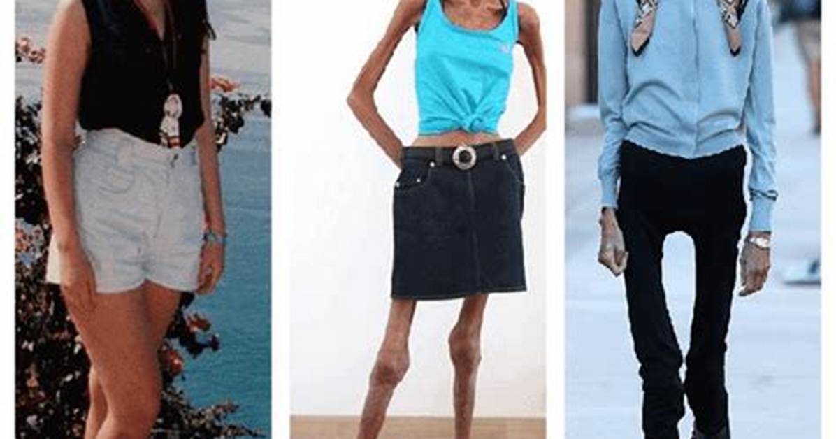 The Truth Behind World S Skinniest Person Searches Medical Facts Ethics And