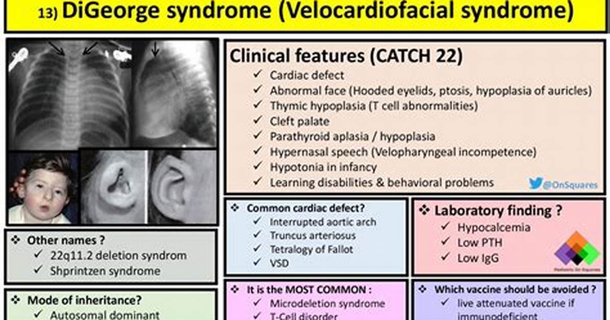Visible Traits vs Reality Identifying Digeorge Syndrome Markers In