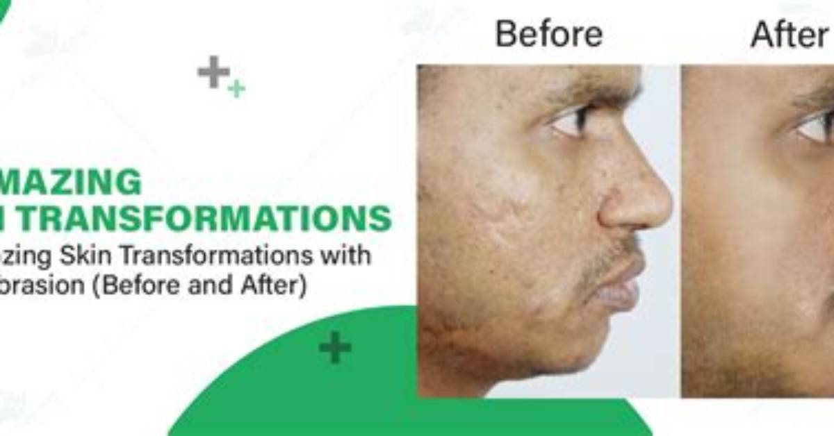 Visual Proof Real Skin Transformations from Highland Thermal Baths and Spa