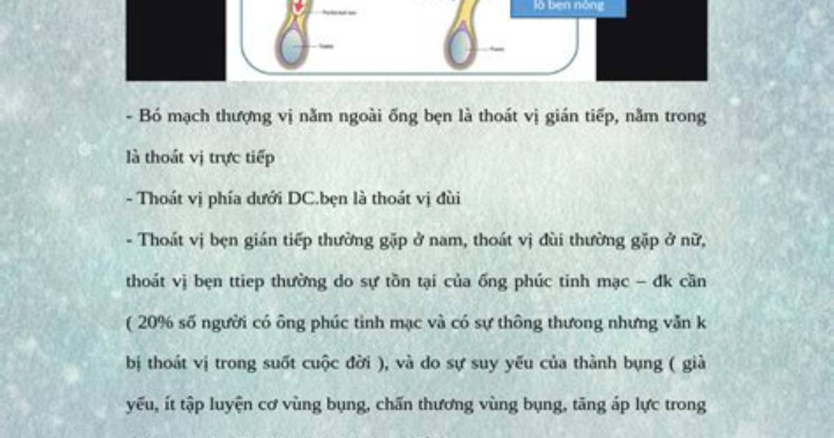 Warudokappu2026Ri Ben Dai Biaono Dui Zhankadoto Shi He Ri Cheng Sen Bao Jian Durasuto Cai Peino Sheng Suanwo Che Di Jie