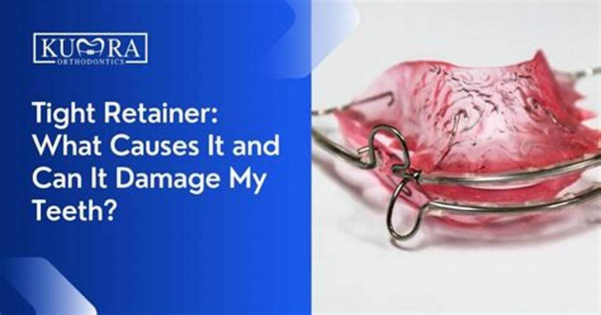 Why Forcing a Tight Retainer Back in Could Destroy