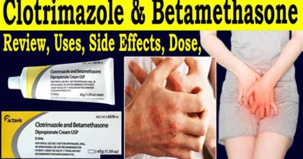 Why Putting Clotrimazole and Betamethasone on Your Face Could