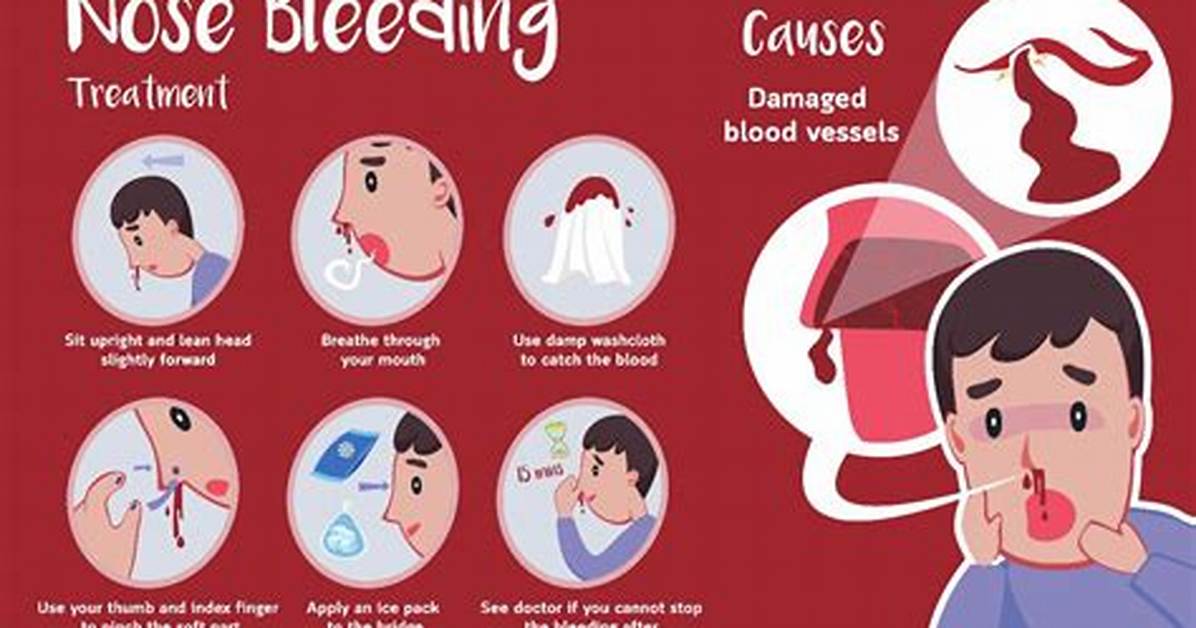 Why You Should Never Force a Nosebleed Medical Hazards and Safe