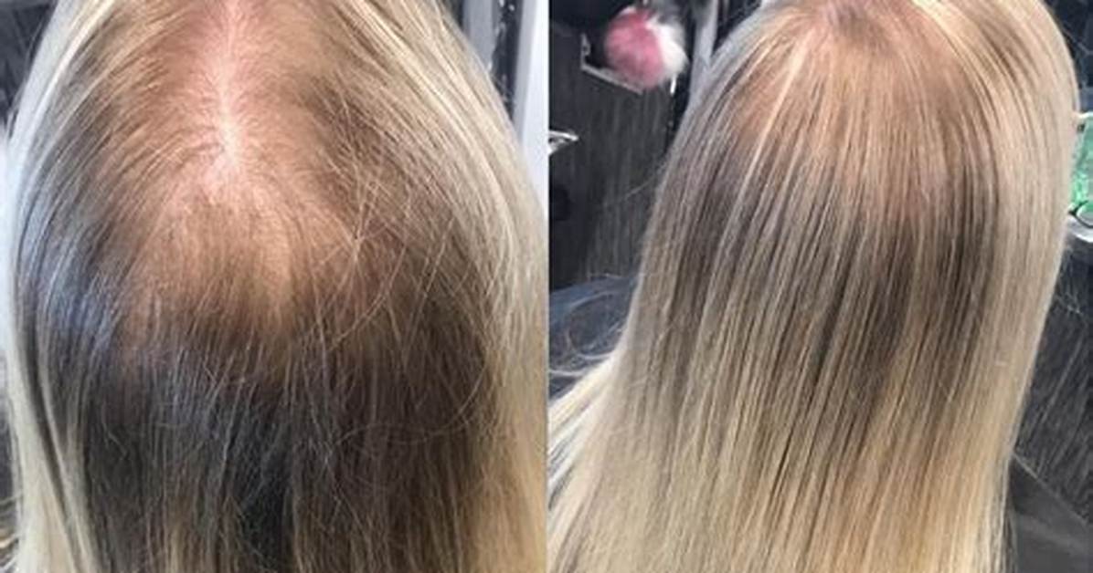 Why Your Current Cut Highlights Thin Hair the 7 Density Mistakes Men