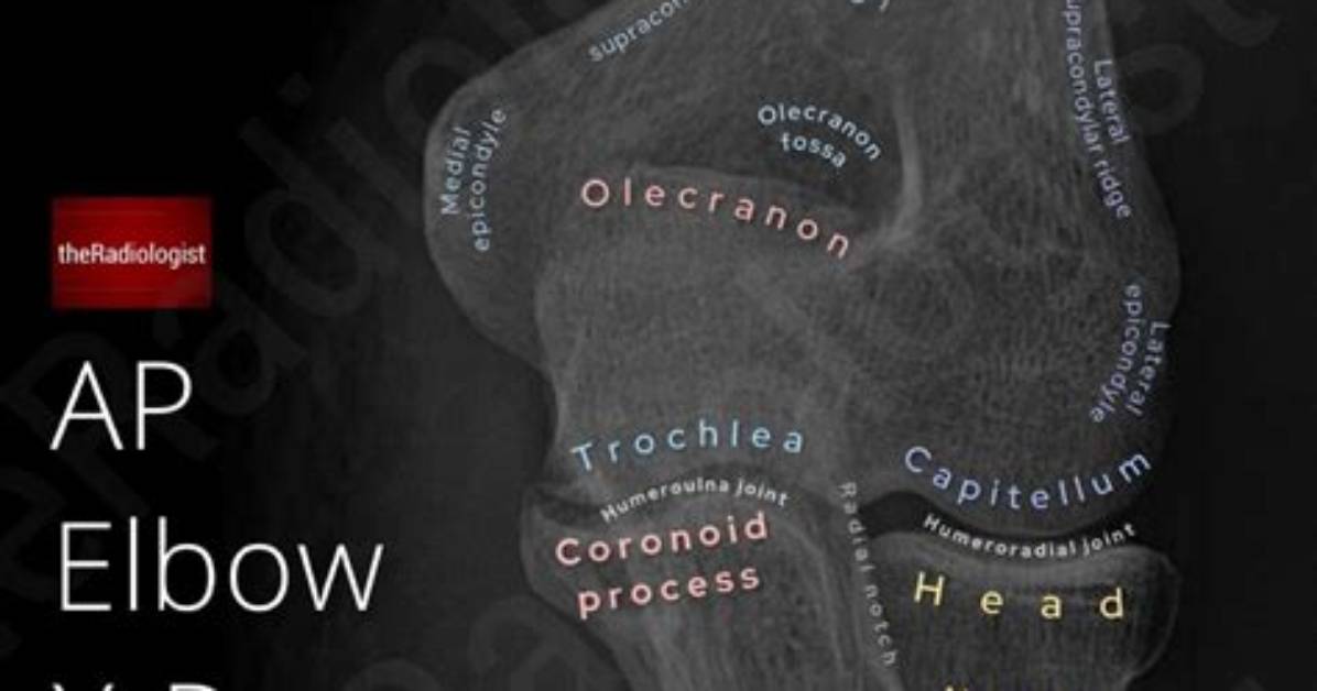 X Ray Anatomy Decoded the Visual Blueprint for Drawing an Anatomically Correct